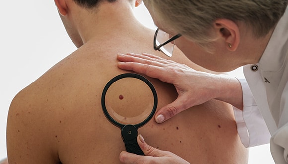 Man getting his skin checked at the doctors